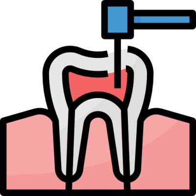 Điều trị tủy răng hiệu quả bằng công nghệ vi phẫu hiện đại, an toàn
