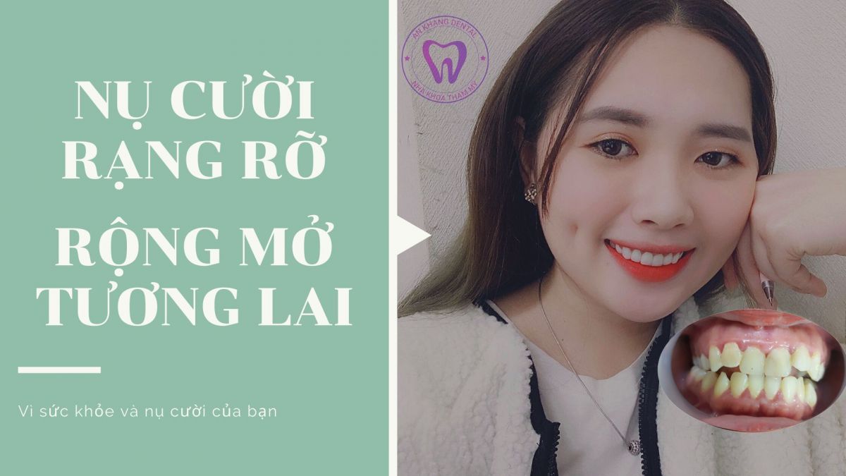 Thói quen giúp răng bạn trắng sáng mỗi ngày